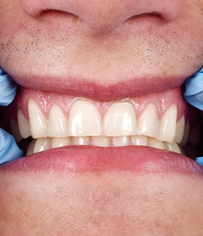 Periodontics and Endodontics | Woodlands Dental | General and Family Dentist | SW Calgary AB